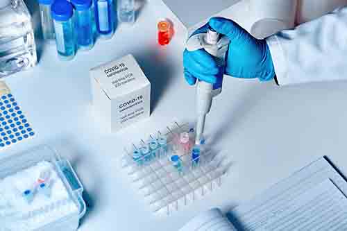 Novel coronavirus 2019 nCoV RT-PCR diagnostics kit. Reagents, primers and control samples to detect presence of 2019-nCoV or covid19 virus. In vitro diagnostic test based on real-time PCR technology.